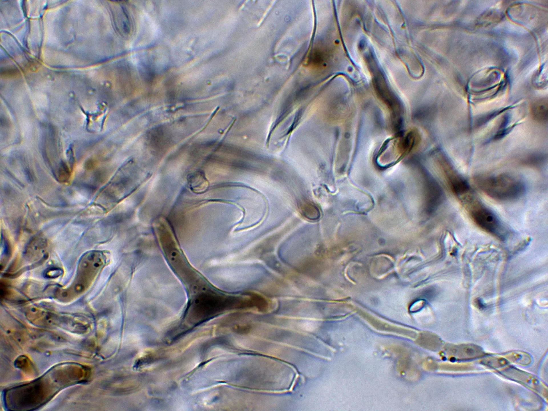 Microscopía de Russula adusta - 10 - Suprapellis agua-003